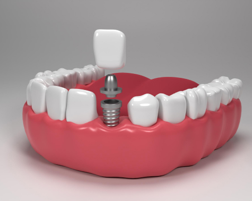 smiley-dental-fairhaven-dental-mobile