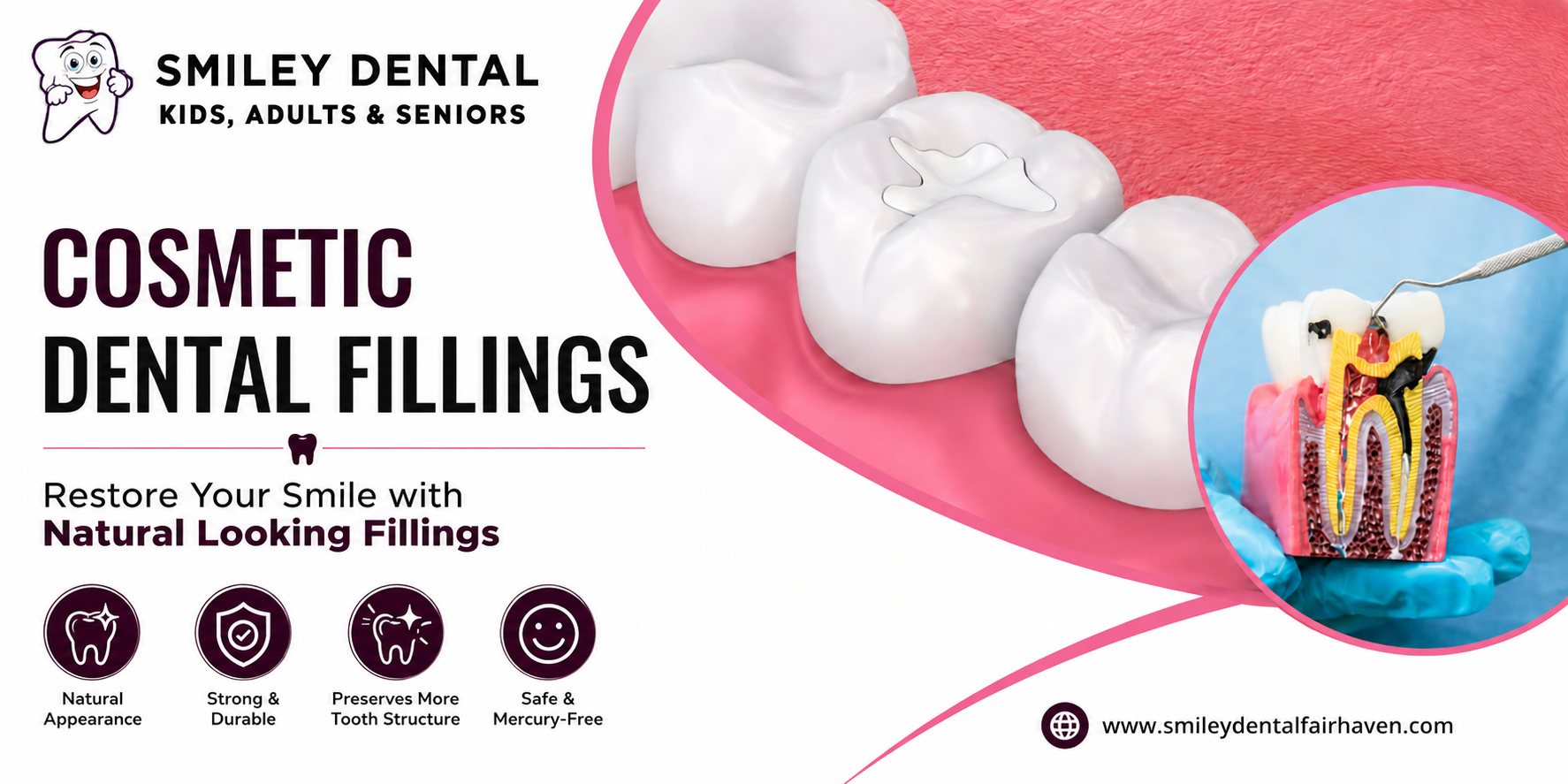 cosmetic dental fillings