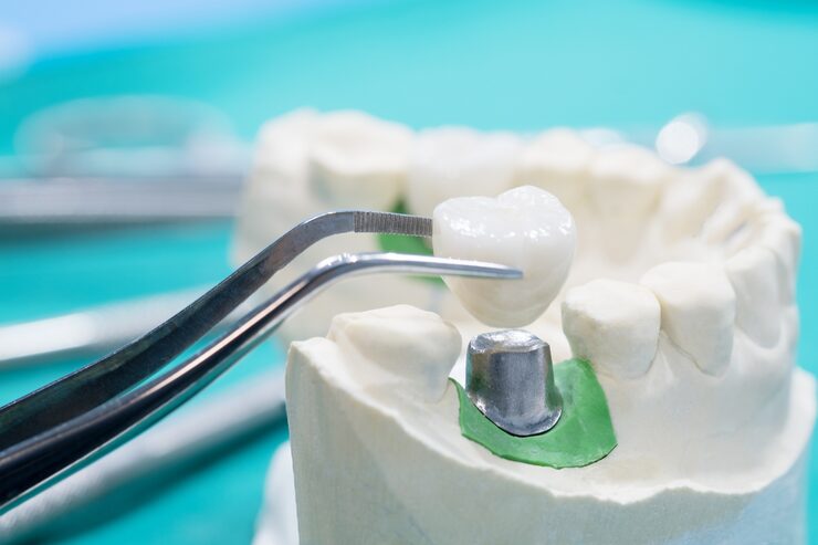 Dental crowns