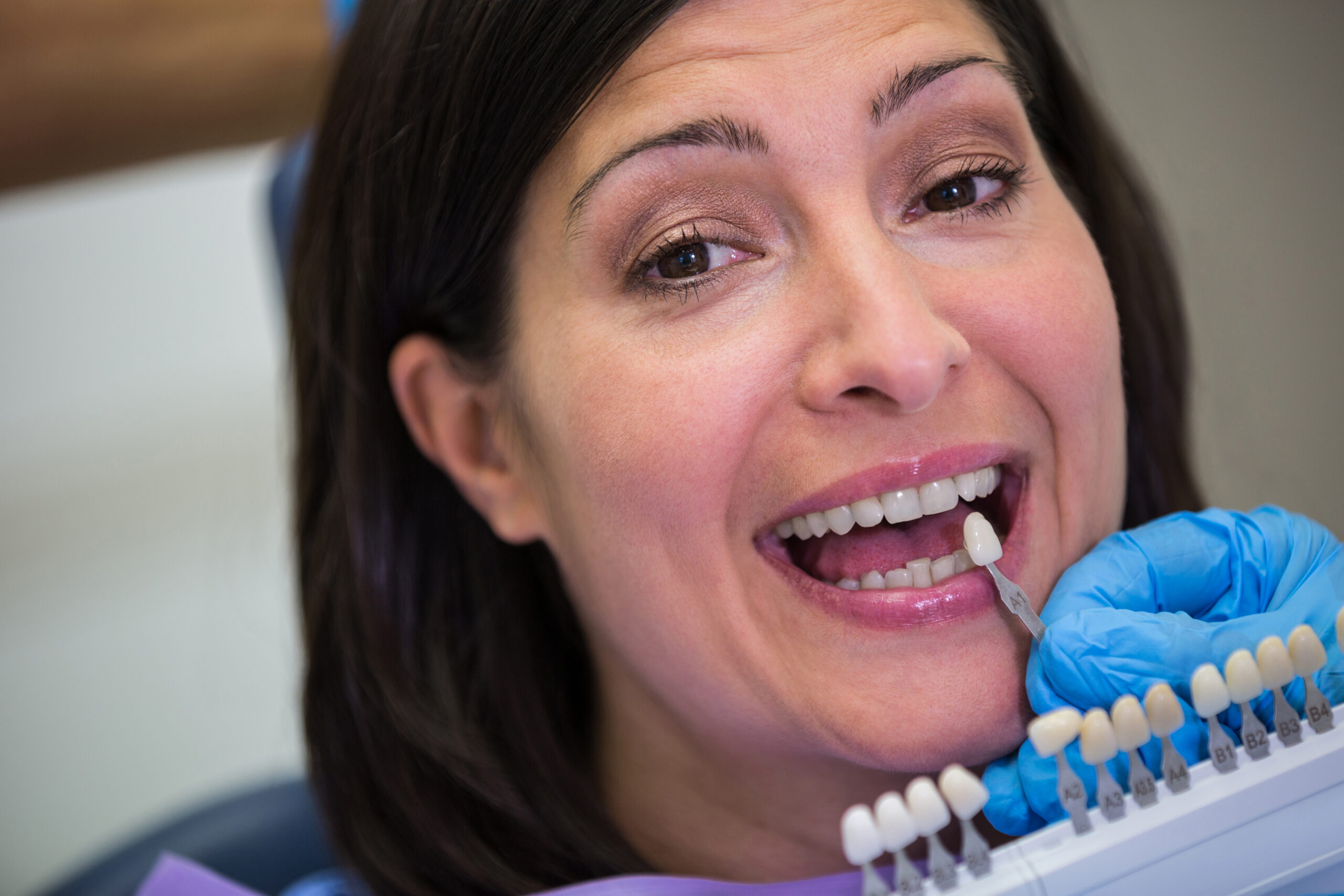 dental crown lifespan
